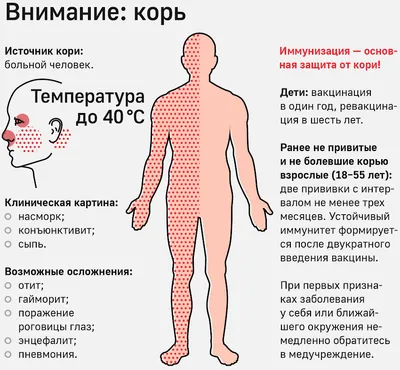 Корь диагностика, лечение и профилактика — Медицинский центр «Целитель»