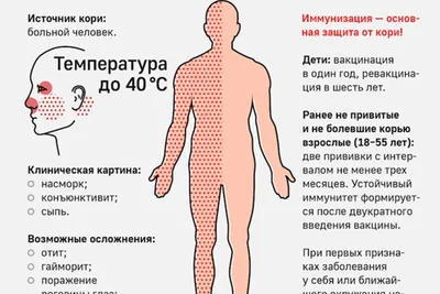 Рекомендации гражданам по профилактике болезни: Корь.