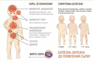 Корь у детей: Вспышка кори в России в 2023 году 🤒 - Евромед Кидс