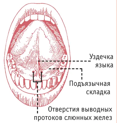 Дермоидная киста корня языка - DENTALMAGAZINE.RU