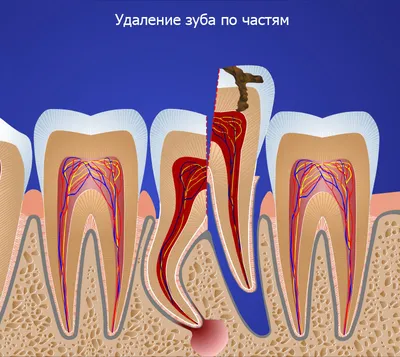 Процесс появления коренных зубов у ребенка – Нова Стоматологія