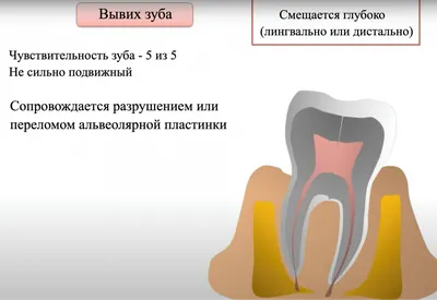 Вырос коренной зуб, а молочный еще не выпал... — 36 ответов | форум Babyblog