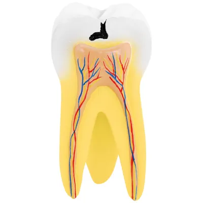 Как отличить молочный зуб от коренного? | DentConsult | Дзен