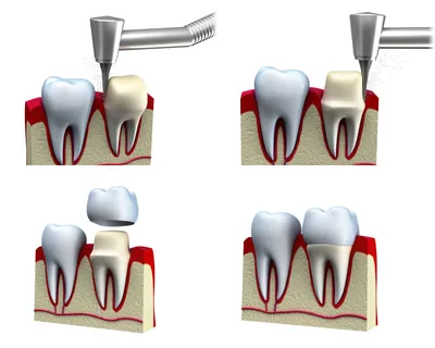 Стоматология DentalHouse - лечение зубов в Бишкеке, все виды  стоматологических услуг