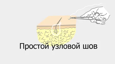 Стерилизация кошки проколом или с косметическим швом