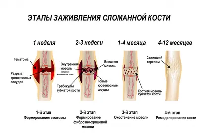 Рентгенография бедренной кости | Портал радиологов