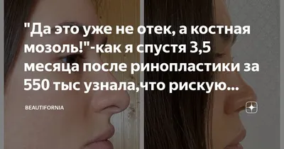 Сколько срастается перелом и как ускорить процесс | Техмедсервис