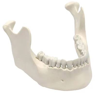 Костная пластика при имплантации зубов - Cтоматология Май