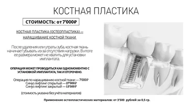 Наращивание костной ткани у метро Орехово в Москве — цены на лечение зубов  в стоматологической клинике «Medical Star»