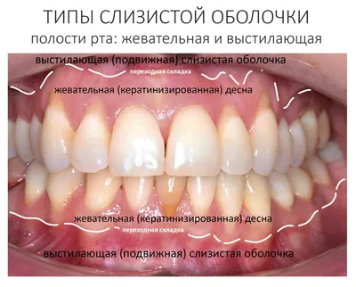 Остеомиелит челюсти - причины, симптомы, стадии, диагностика, лечение  (операция), осложнения, профилактика