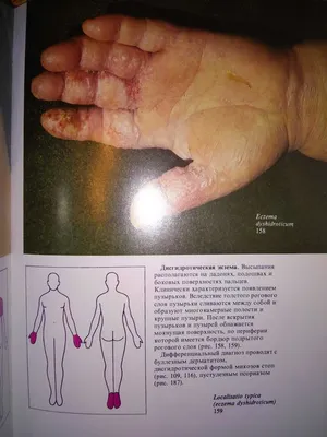 Желтаков М. М. Кожные и венерические болезни