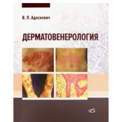 Генитальные и перианальные заболевания — купить книги на русском языке в  DomKnigi в Европе