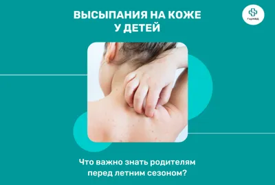 Гнойничковые высыпания у детей | 1ДМЦ