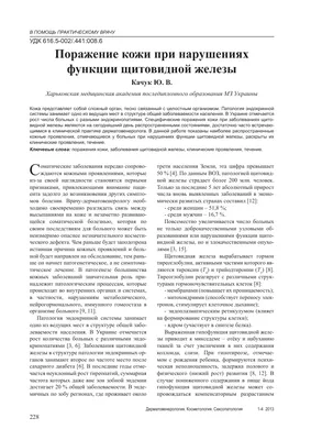 Крапивница: симптомы и лечение — причины появления у взрослых и детей,  лекарства от болезни