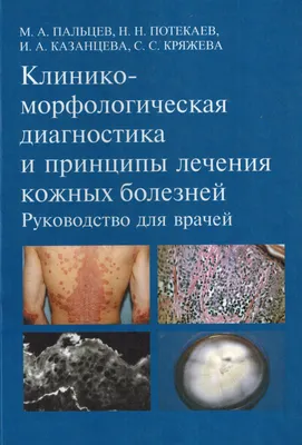 Купероз на лице: причины и лечение, как бороться и избавиться от купероза