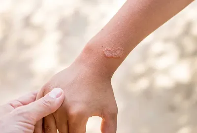 Как внутренние заболевания проявляются на коже | РБК Стиль