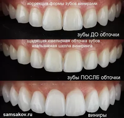 Красивые зубы - это хорошее самочувствие , профессиональный  успех,социальное признание и ,конечно же , ослепительная, уверенная улыбка…  | Instagram