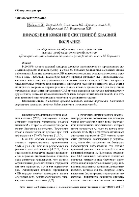 Красная волчанка - что это? Симптомы, лечение красной волчанки