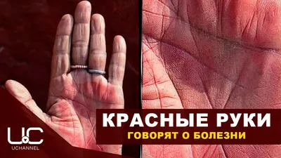 Эксперт объяснила, почему потеют ладони и дергается глаз | «Красный Север»