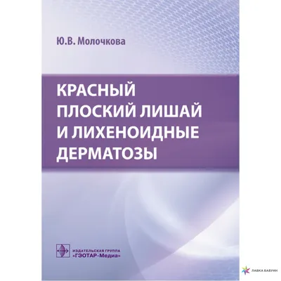 Лишай красный плоский. Клинические рекомендации.