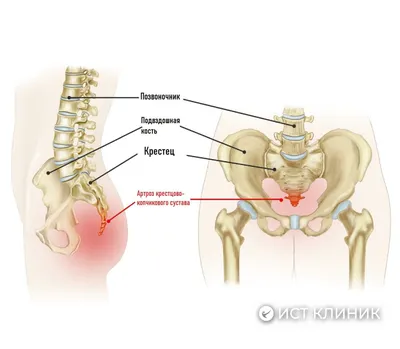 Крестец и копчик плакат глянцевый А1/А2 › Купить оптом и в розницу › Цена  от завода