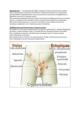 Лапароскопия крипторхизм у детей, лечение, цена хирургической операции. |  Москва