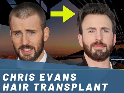 Marvel's Chris Evans ditched Los Angeles for his mental health