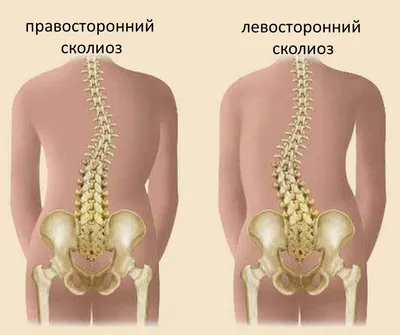 Кривая Спина — стоковые фотографии и другие картинки Плохая осанка - Плохая  осанка, Без людей, Белый фон - iStock