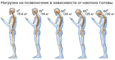 Болит поясница после ношения тяжестей? Что делать? | медицинские товары и  медтехника в магазине Ортосалон