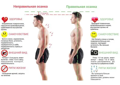 Что будет, если заниматься спортом с неправильной осанкой