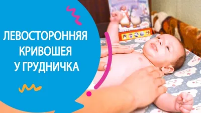 ЛЕВОСТОРОННЯЯ КРИВОШЕЯ У ГРУДНИЧКА 2 МЕСЯЦА - YouTube