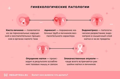 Боли внизу живота у женщины при овуляции, месячных, сексе: Причины и  лечение | Мегаптека.ру