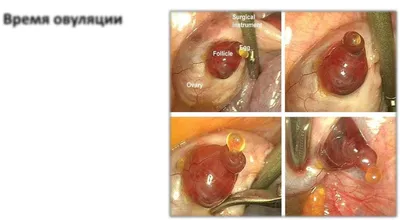 Кровь При Овуляции Фото - Фото и картинки