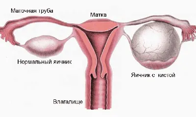 Кровянистые выделения, не связанные с месячными: определение и причины  появления