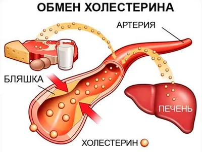 Радиоволновое удаление ксантелазмы на веке - «Я думала, будет намного  проще. Мой долгий путь к этой процедуре и результат.» | отзывы