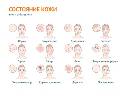 Novel filagrinol-containing emollient - Snarskaya - Vestnik dermatologii i  venerologii