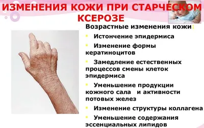 Ксероз кожи может образоваться у... - Маникюр.Педикюр.Подолог | Facebook