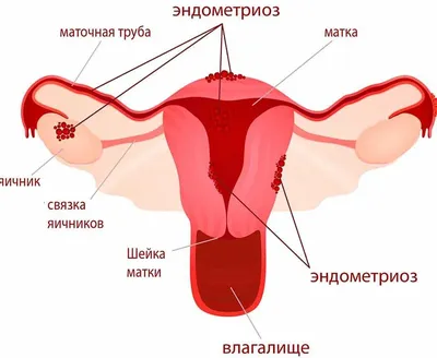 Девочки, умоляю, ответьте, это выкидыш? - Вопросы о беременности - BabyPlan