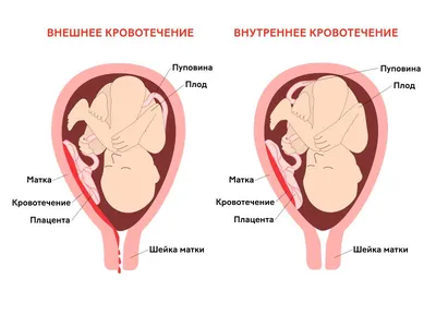 Диета при эндометриозе - «Очень личная история про самую загадочную женскую  болезнь и действенный способ облегчить страдания» | отзывы