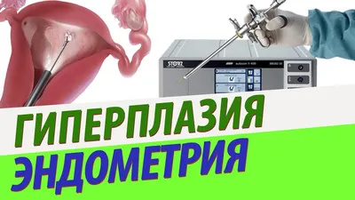Биопсия шейки матки в Москве - цены в клинике АльтраВита
