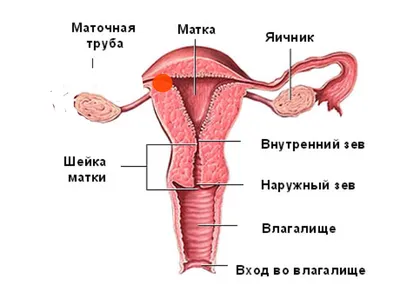 Кусочки эндометрия при месячных фото