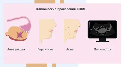 Почему бывают большие сгустки при месячных?» — Яндекс Кью