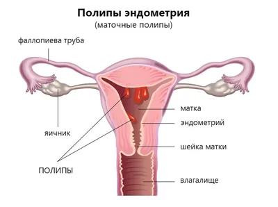 Что это за выделения? День) простите пожалуйста , у меня такой вопрос. |  MedAboutMe