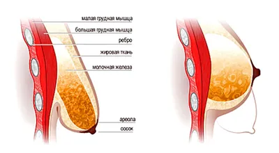 Уменьшить грудь с помощью операции | Астана