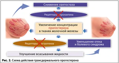 Лактостаз: что делать при застое молока в груди? — Благотворительный фонд  помощи недоношенным детям «Право на чудо»