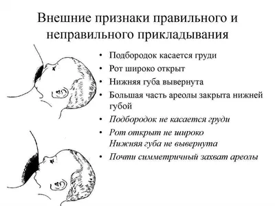 Лактостаз при грудном вскармливании: симптомы, лечение, массаж, отличия от  мастита