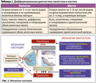 cp_profilaktika - ЧТО ДЕЛАТЬ ПРИ ЛАКТОСТАЗЕ? ⠀ Одна из... | Facebook