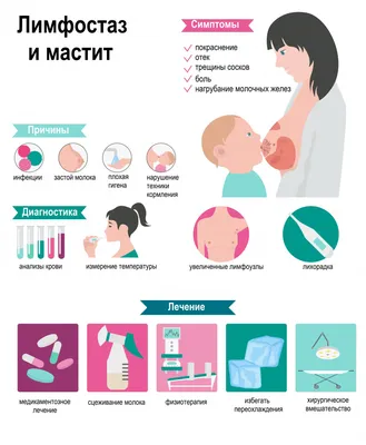 Застой молока у кормящих женщин, или лактостаз - причины появления, при  каких заболеваниях возникает, диагностика и способы лечения