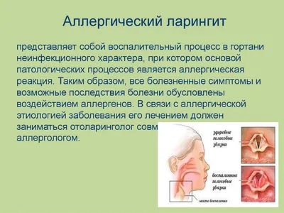 Лечение ларингита у детей и взрослых - симптомы, диагностика, профилактика