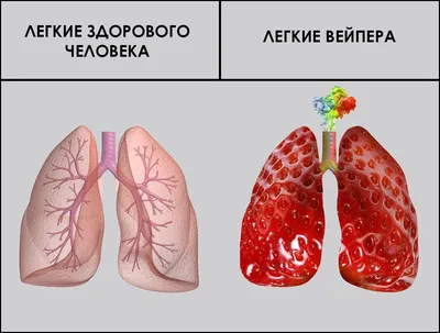 Легкие здорового человека Легкие курильщика Легкие человека, который плывет  под водой в любом фи / рак (болезнь) :: лёгкие :: рак лёгких :: кино /  смешные картинки и другие приколы: комиксы, гиф